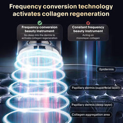 3-in-1 Beauty Device – RF & Microcurrent & Light Therapy